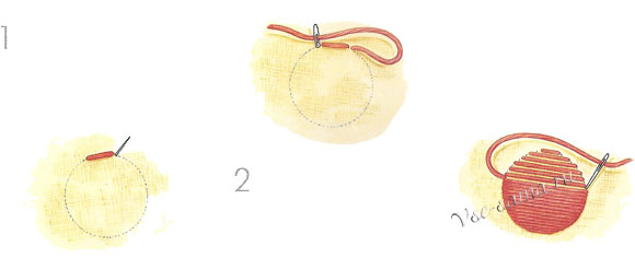 Заполняющие швы-1