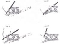 Скрещенные столбики Скрещенные столбики