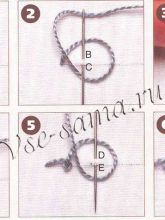 Узелковый шов Узелковый шов